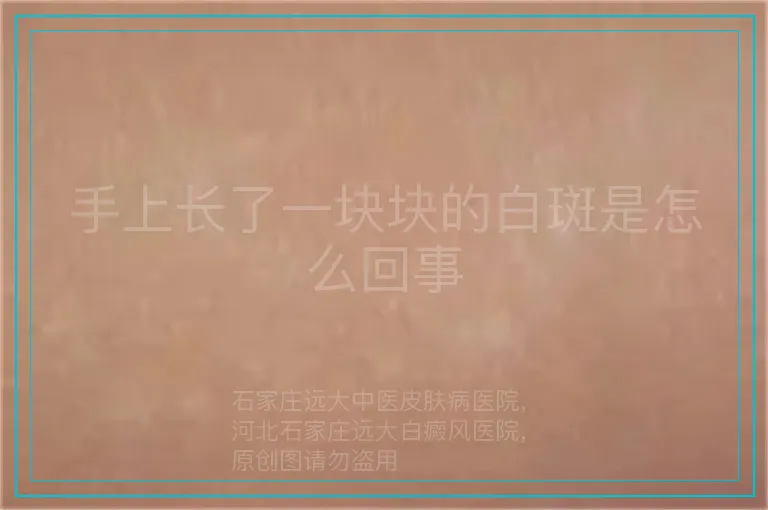 手上长了一块块的白斑是怎么回事