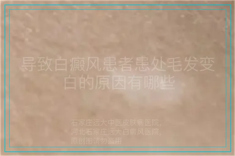 导致白癜风患者患处毛发变白的原因有哪些