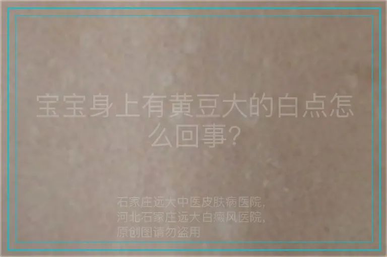 宝宝身上有黄豆大的白点怎么回事?