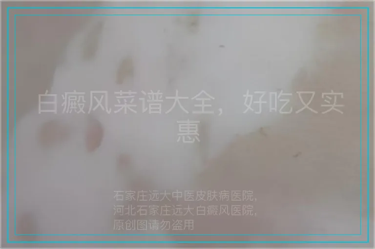 白癜风菜谱大全，好吃又实惠