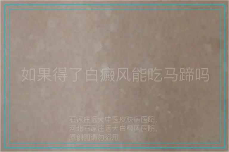 如果得了白癜风能吃马蹄吗