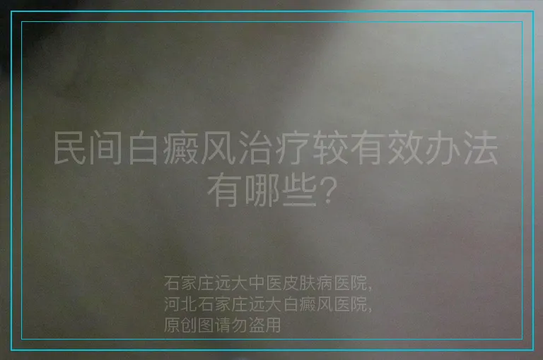 民间白癜风治疗较有效办法有哪些?