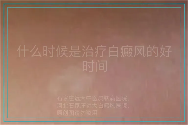 什么时候是治疗白癜风的好时间