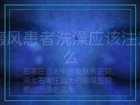 白癜风患者洗澡应该注意什么
