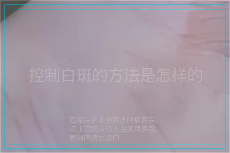 控制白斑的方法是怎样的