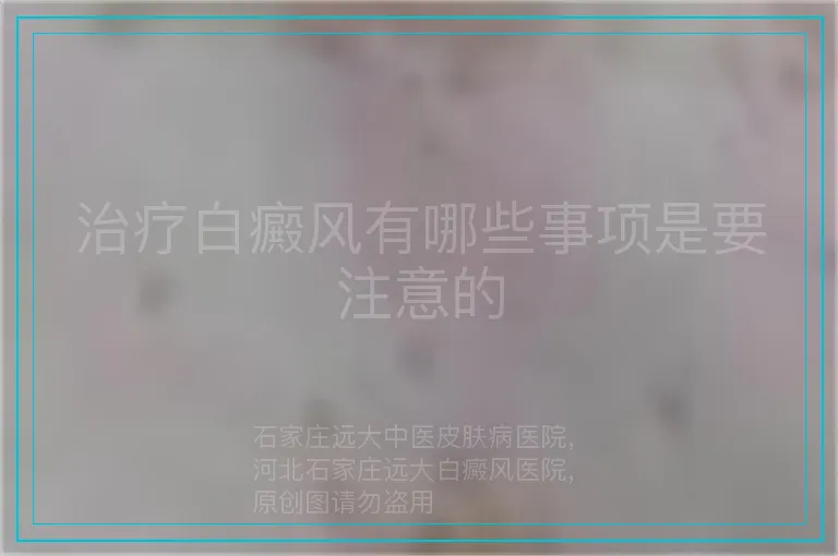 治疗白癜风有哪些事项是要注意的