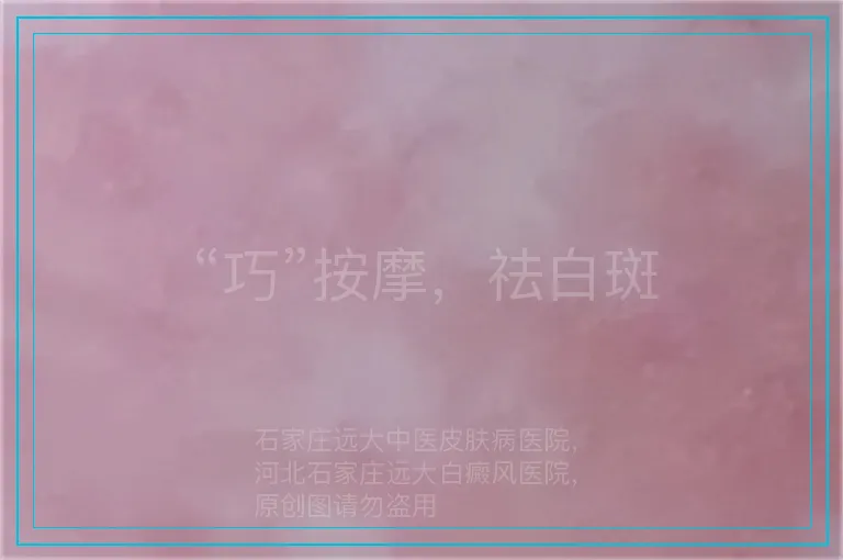 “巧”按摩,祛白斑