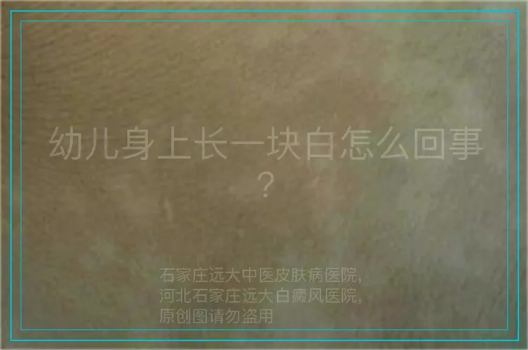 幼儿身上长一块白怎么回事?