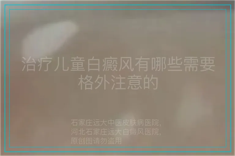 治疗儿童白癜风有哪些需要格外注意的