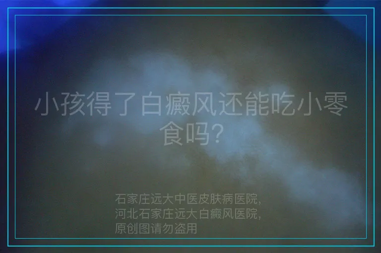 小孩得了白癜风还能吃小零食吗？