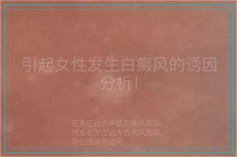 引起女性发生白癜风的诱因分析！