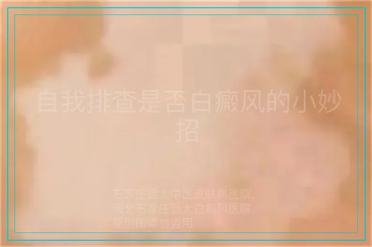 自我排查是否白癜风的小妙招