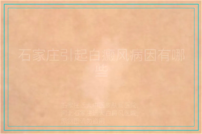 石家庄引起白癜风病因有哪些