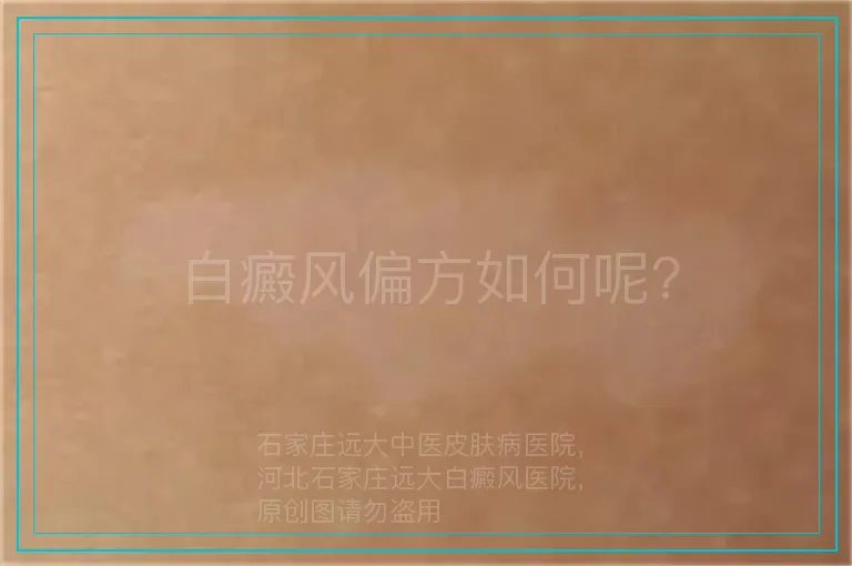 白癜风偏方如何呢?