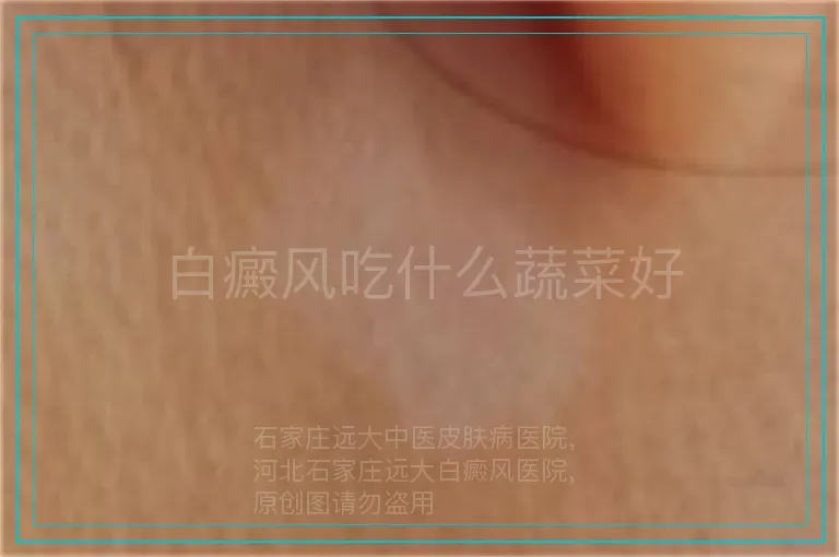 白癜风吃什么蔬菜好