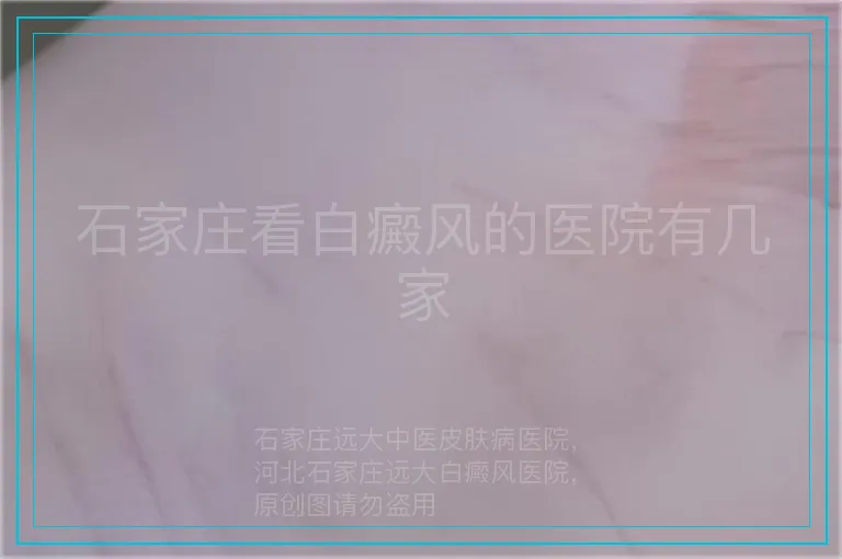 石家庄看白癜风的医院有几家