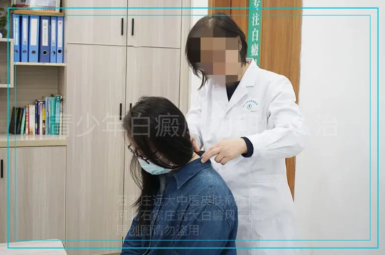 青少年白癜风初期怎么治