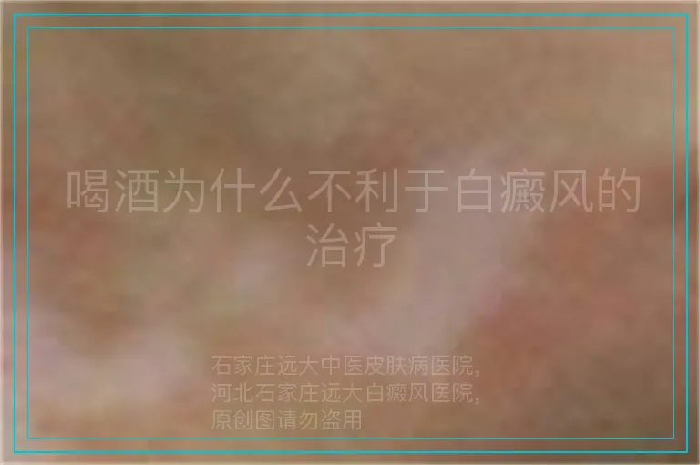 喝酒为什么不利于白癜风的治疗