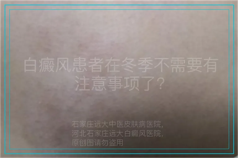 白癜风患者在冬季不需要有注意事项了?