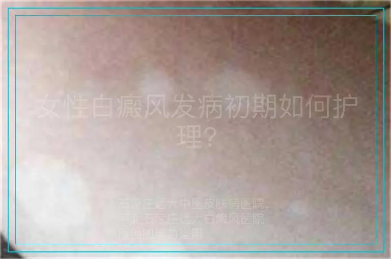 女性白癜风发病初期如何护理?