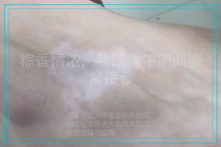 粽香情浓,我院端午期间照常接诊