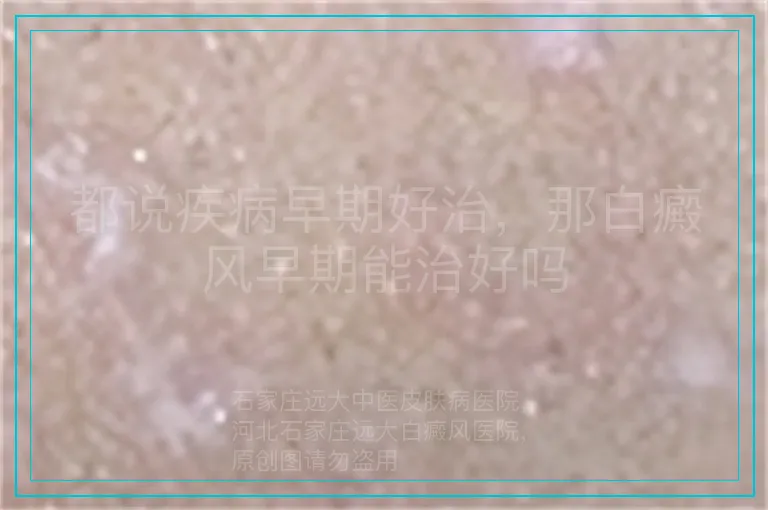 都说疾病早期好治,那白癜风早期能治好吗