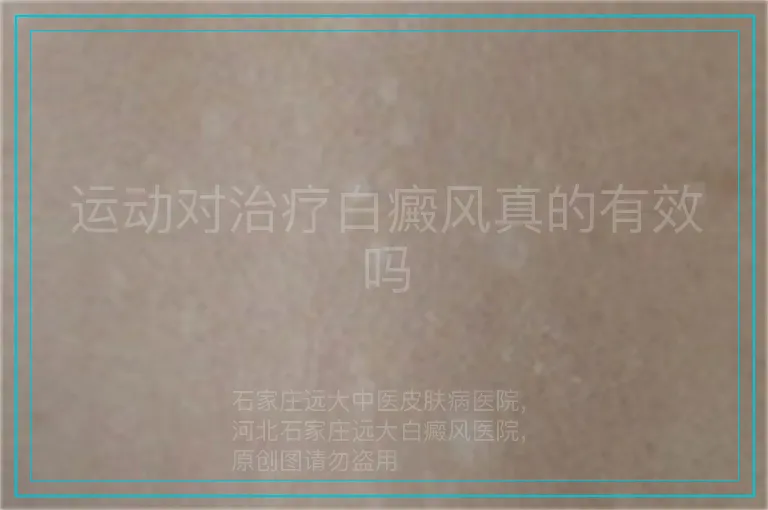 运动对治疗白癜风真的有效吗