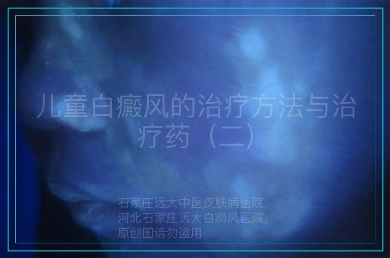 儿童白癜风的治疗方法与治疗药（二）