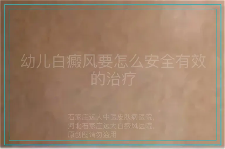 幼儿白癜风要怎么安全有效的治疗