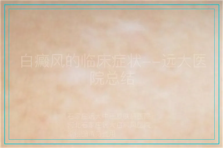 白癜风的临床症状--远大医院总结