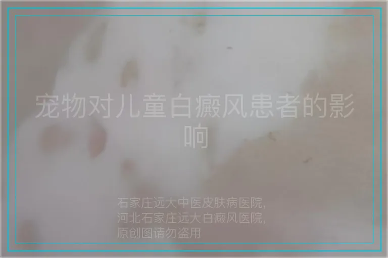 宠物对儿童白癜风患者的影响
