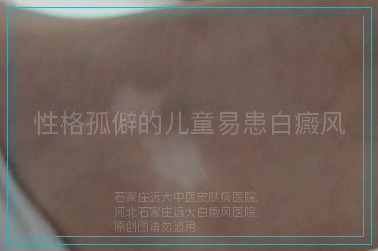 性格孤僻的儿童易患白癜风