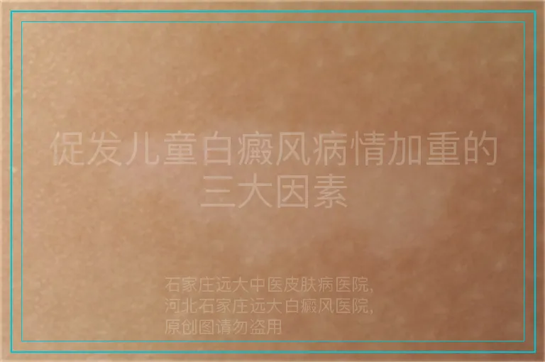 促发儿童白癜风病情加重的三大因素