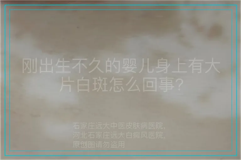 刚出生不久的婴儿身上有大片白斑怎么回事?