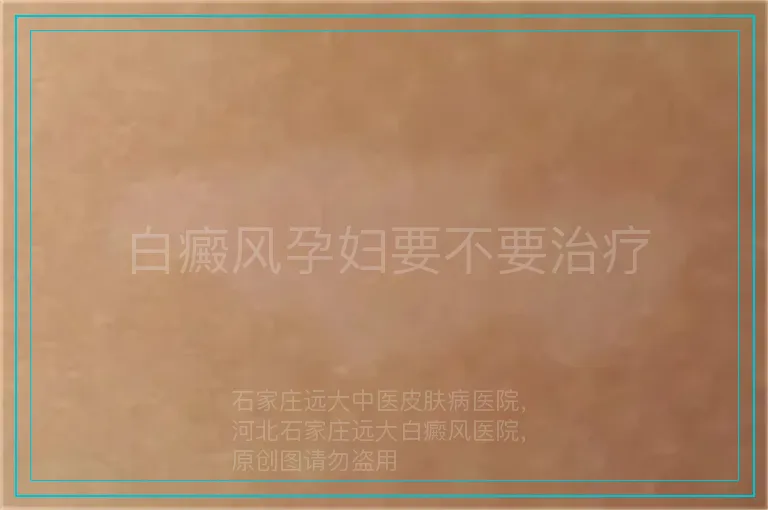 白癜风孕妇要不要治疗