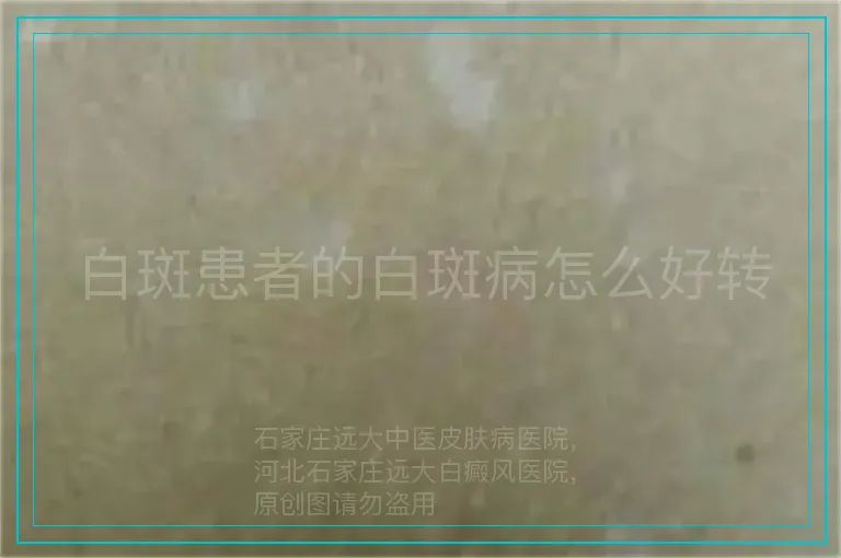 白斑患者的白斑病怎么好转
