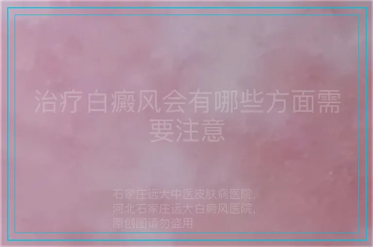 治疗白癜风会有哪些方面需要注意
