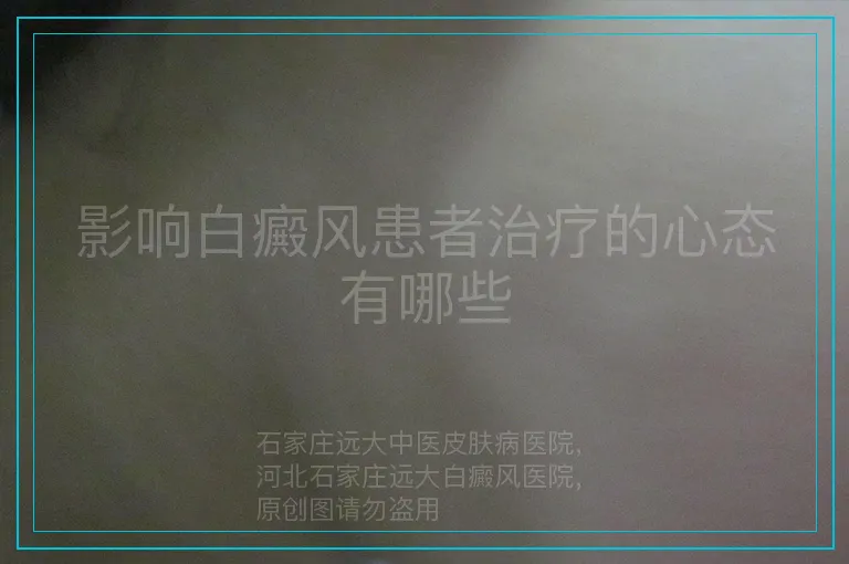 影响白癜风患者治疗的心态有哪些