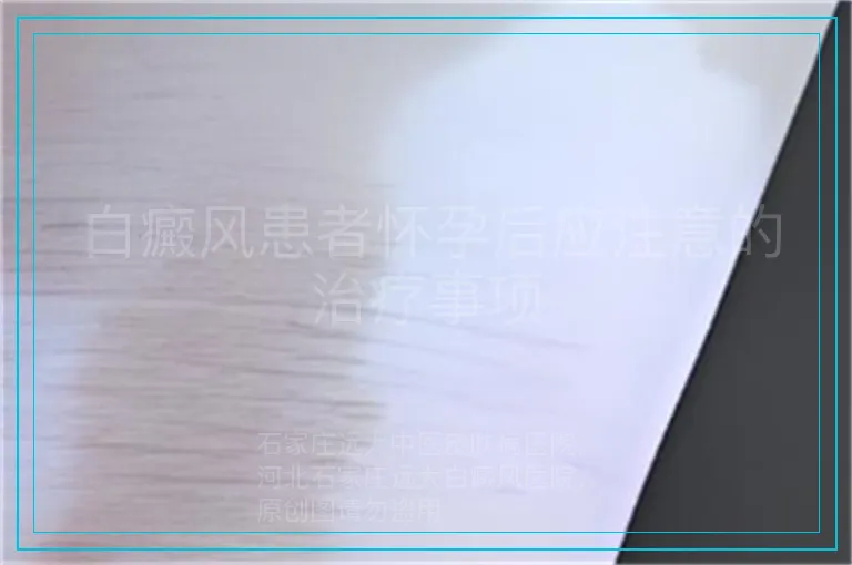 白癜风患者怀孕后应注意的治疗事项