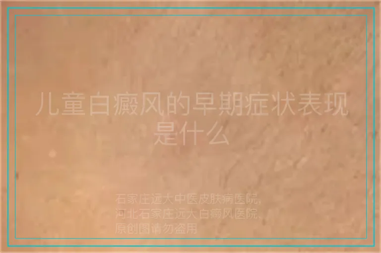 儿童白癜风的早期症状表现是什么