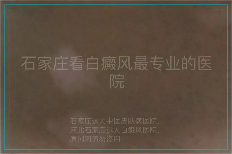 石家庄看白癜风最专业的医院