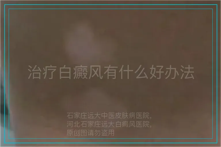 治疗白癜风有什么好办法