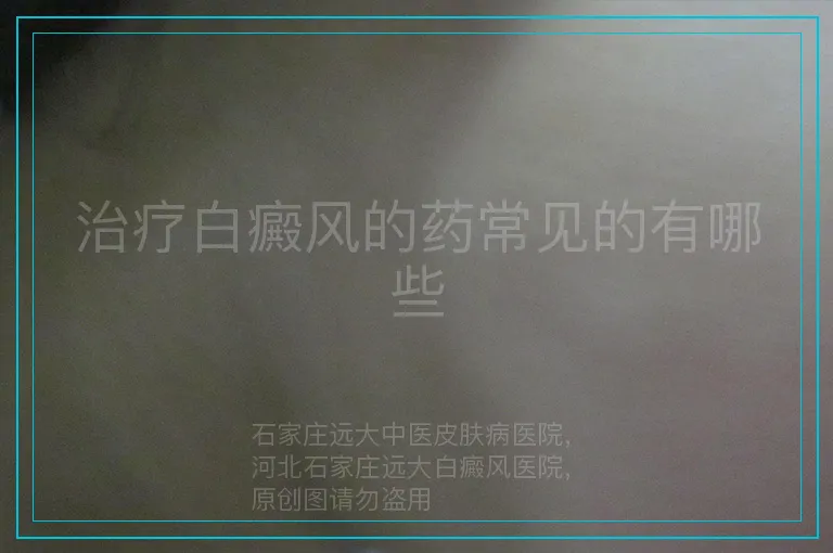 治疗白癜风的药常见的有哪些