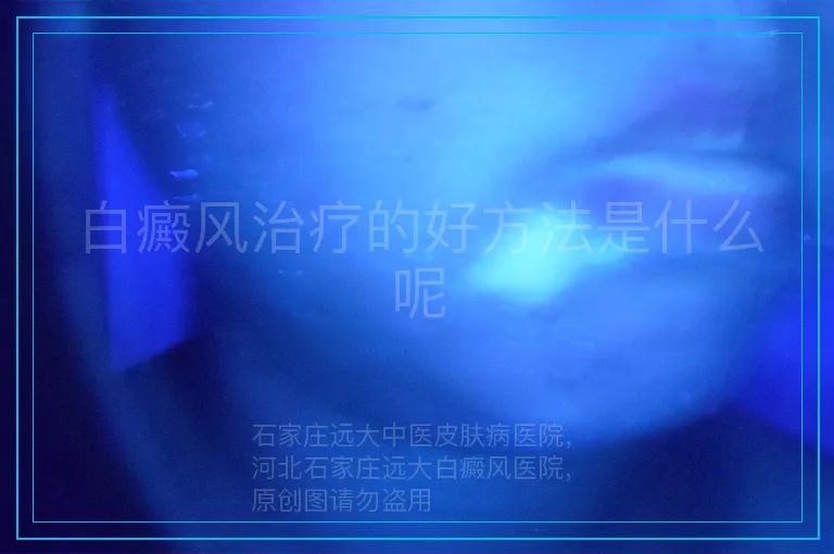 白癜风治疗的好方法是什么呢