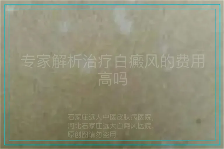 专家解析治疗白癜风的费用高吗