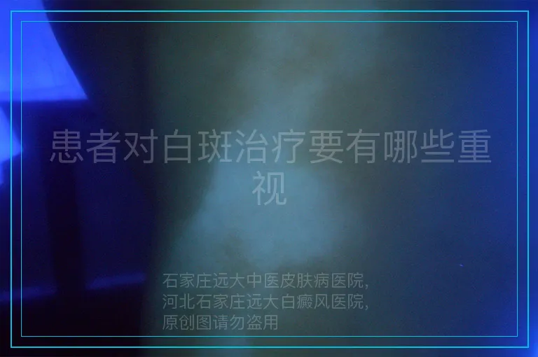 患者对白斑治疗要有哪些重视