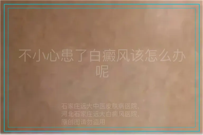不小心患了白癜风该怎么办呢
