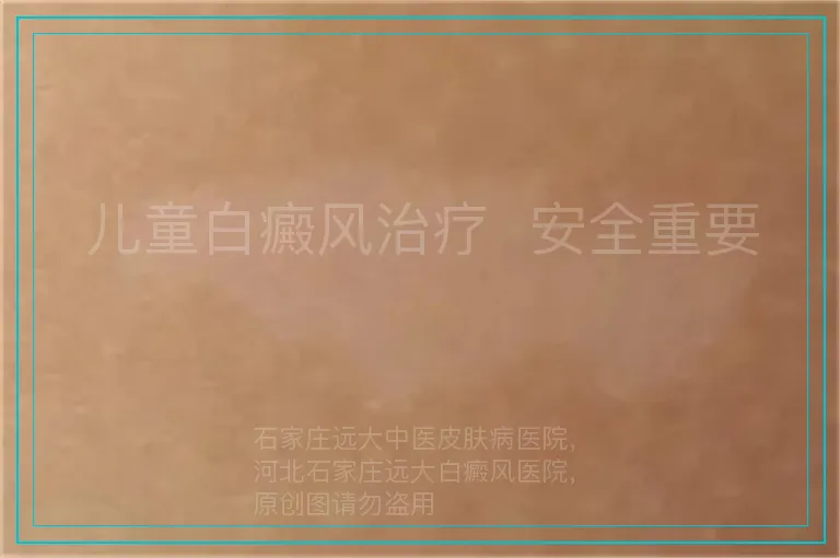 儿童白癜风治疗 安全重要