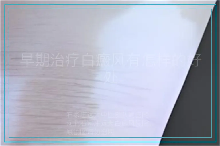 早期治疗白癜风有怎样的好处