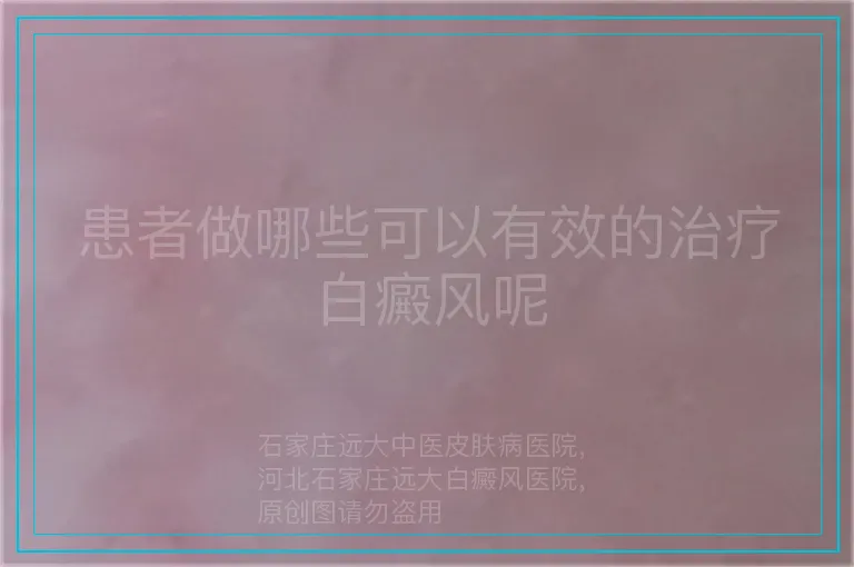 患者做哪些可以有效的治疗白癜风呢